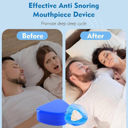 The Quiet Anti-Snoring Mouthpiece Universal Size